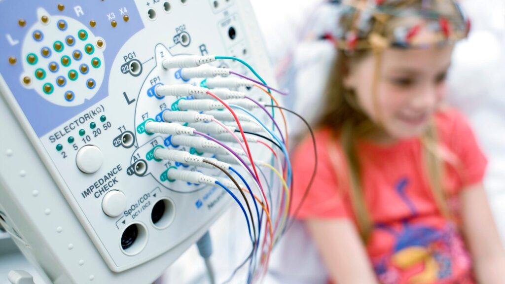 Nörolojik Rahatsızlık Tedavisi